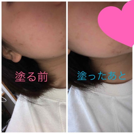 スキンケアパウダー/素肌記念日/プレストパウダーを使ったクチコミ(3枚目)