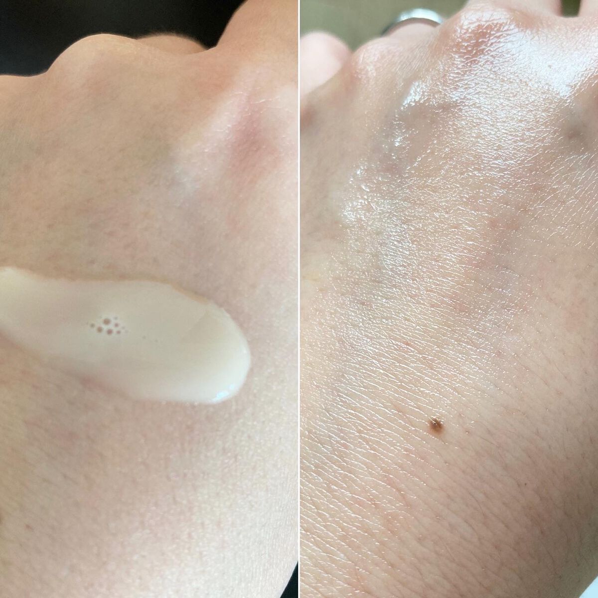 VC100エッセンスローション EX/ドクターシーラボⓇ/化粧水を使ったクチコミ(7枚目)