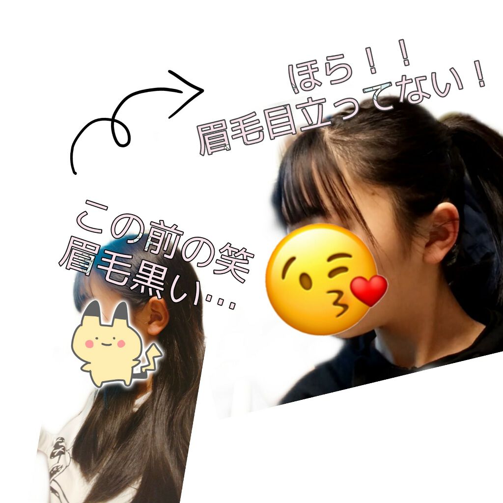 脱色クリーム 敏感肌用/エピラット/ムダ毛ケアを使ったクチコミ(4枚目)