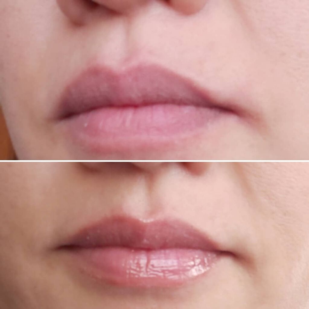 38°C / 99°F リップトリートメント (リップ美容液)/UZU BY FLOWFUSHI/リップケアを使ったクチコミ(3枚目)