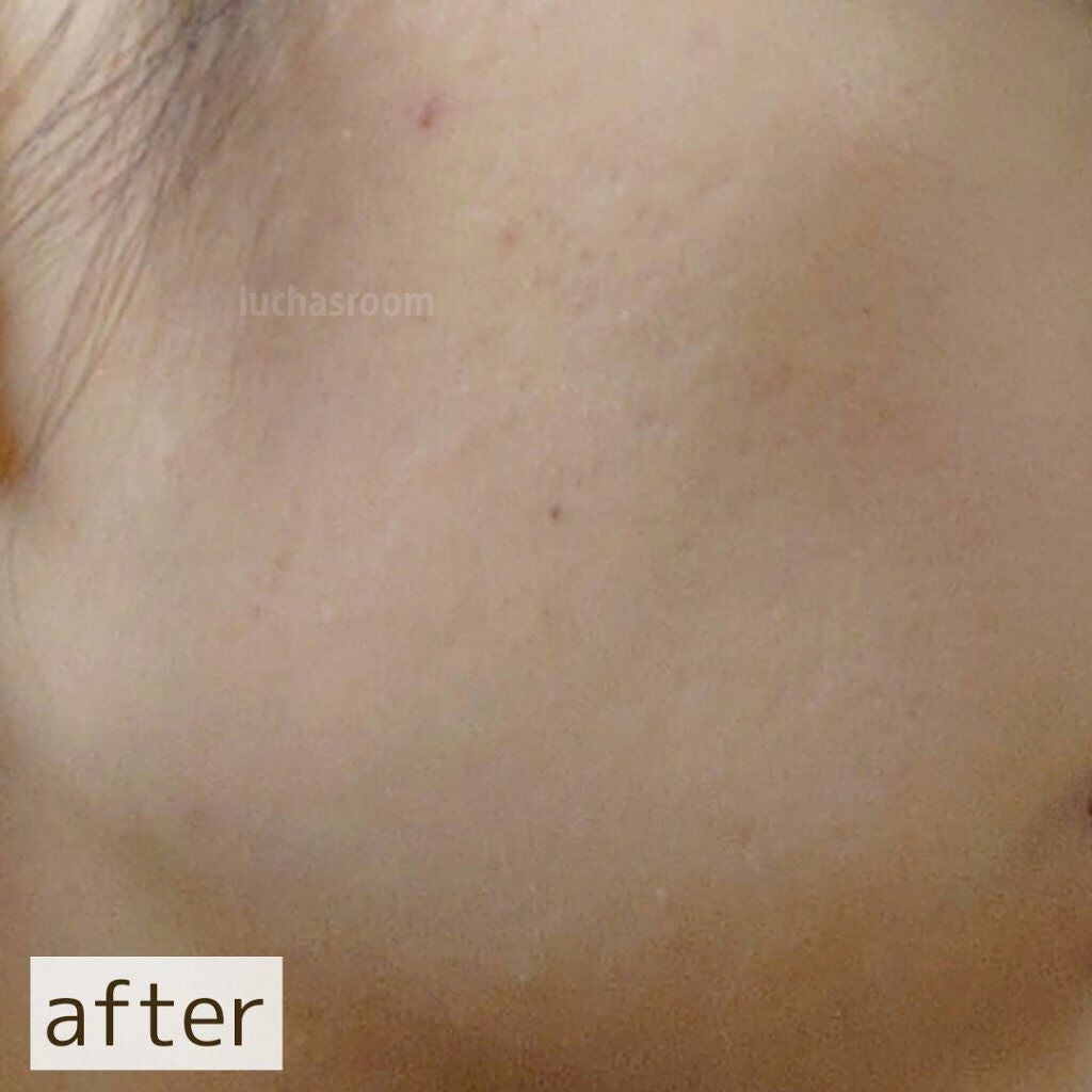 UVイデア XL プロテクショントーンアップ ローズ/ラ ロッシュ ポゼ/日焼け止めクリームを使ったクチコミ(5枚目)