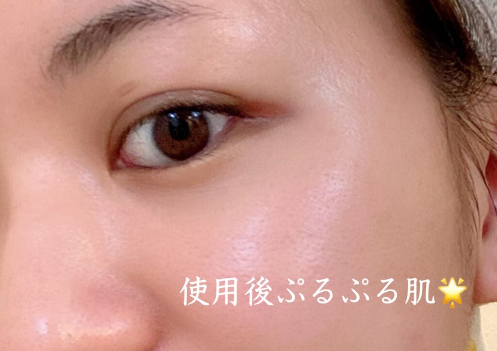 レーヌブランシュ ホワイトインフュージョンジェルクリーム/L'OCCITANE/フェイスクリームを使ったクチコミ(4枚目)