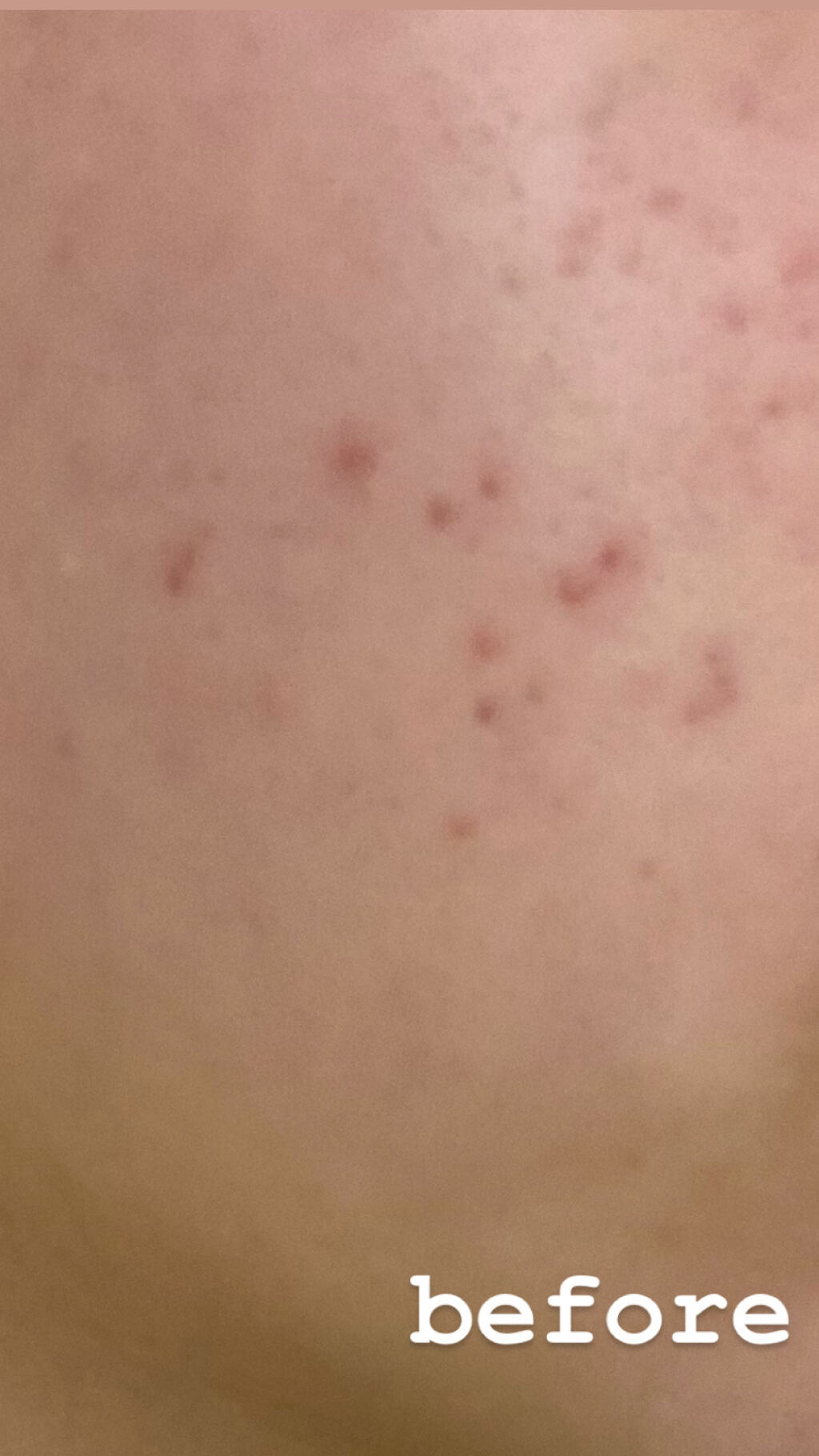 DHC ビタミンＣハードカプセル/DHC/美容サプリメントを使ったクチコミ（3枚目）