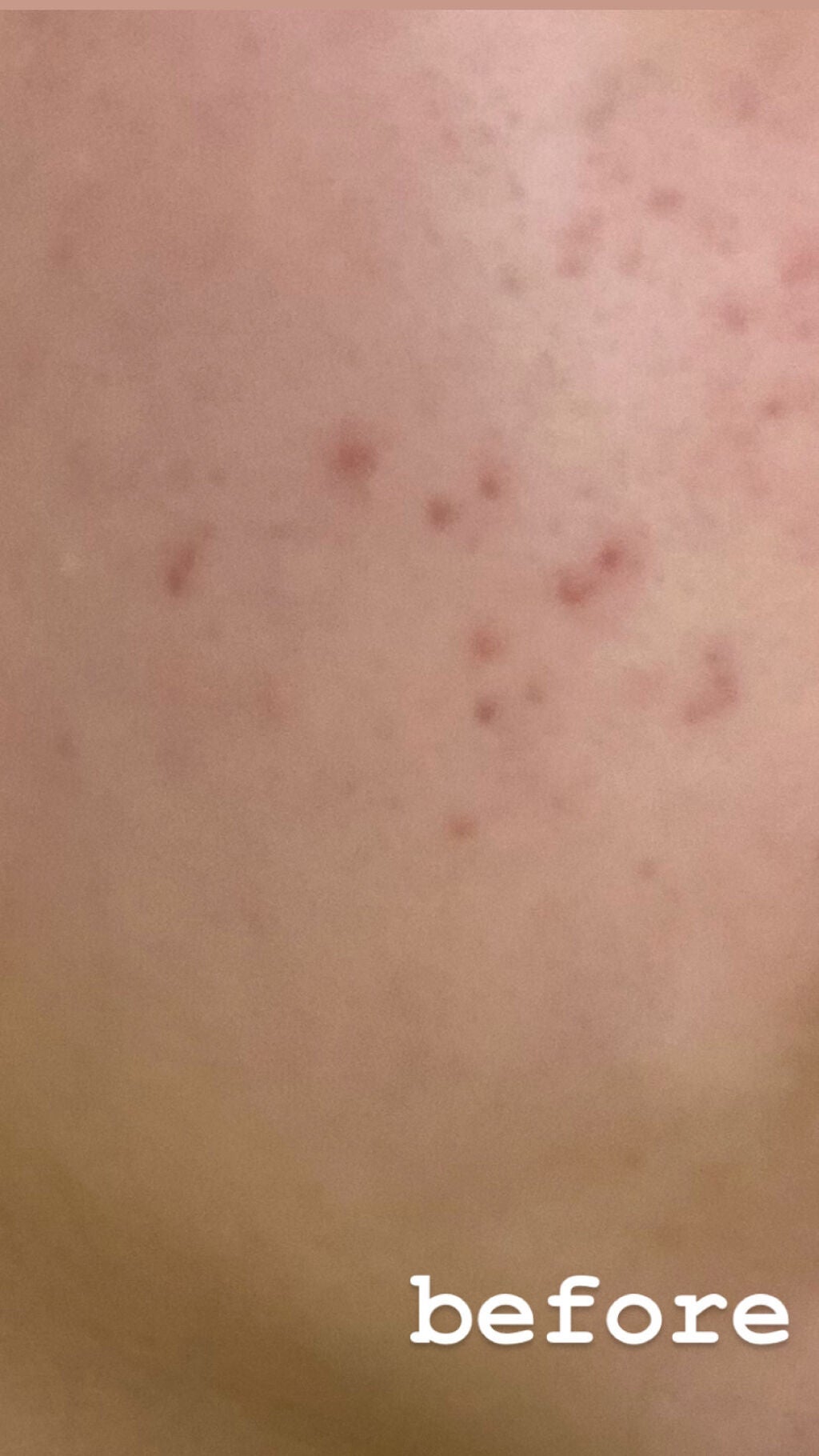 DHC ビタミンCハードカプセル/DHC/美容サプリメントを使ったクチコミ(3枚目)