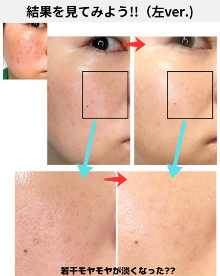 めがねちゃん👓フォロバ on LIPS 「←こちらから過去のおすすめが見られます✨元化粧品研究者のめがね..」(7枚目)