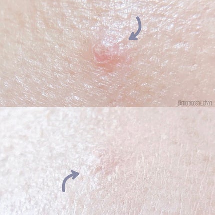 マスクフィットオールカバーデュアルコンシーラー/TIRTIR(ティルティル)/コンシーラーを使ったクチコミ(4枚目)