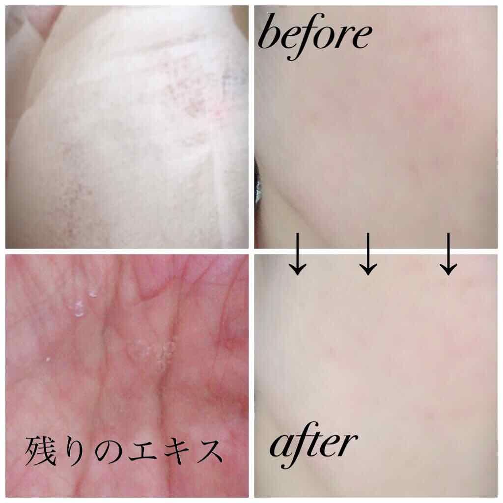 0.2エアフィットマスク/ETUDE/シートマスク・パックを使ったクチコミ(3枚目)