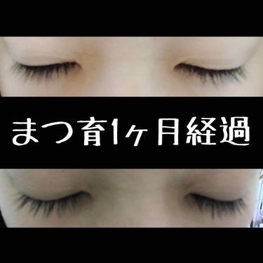 リアルまつ育を始めてからはや1ヶ月🥺

ちゃんと私にも効果が期待できました！！！
今までほんとに続かなくて三日坊主でしたが
値段が高かったので毎日欠かさず塗りました👀✨

私が使っているのは
エマーキッ