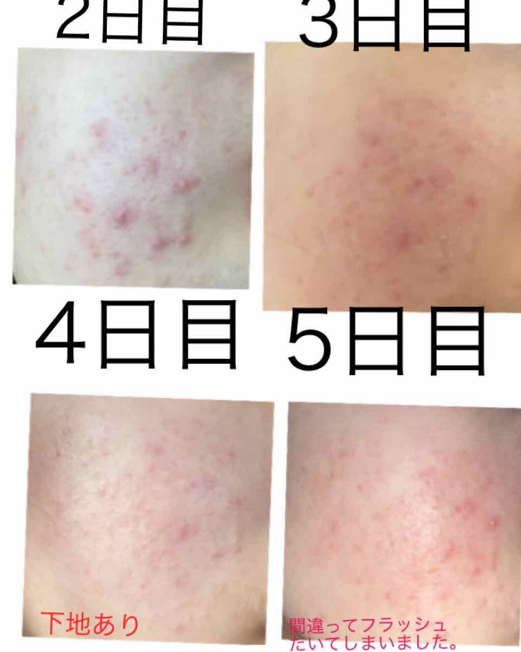 オードムーゲ 薬用ローション(ふきとり化粧水)/オードムーゲ/拭き取り化粧水を使ったクチコミ(2枚目)