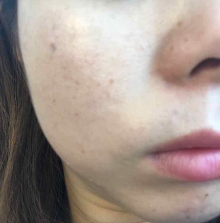 薬用ホワイトニングCCクリーム/トランシーノ/CCクリームを使ったクチコミ(4枚目)