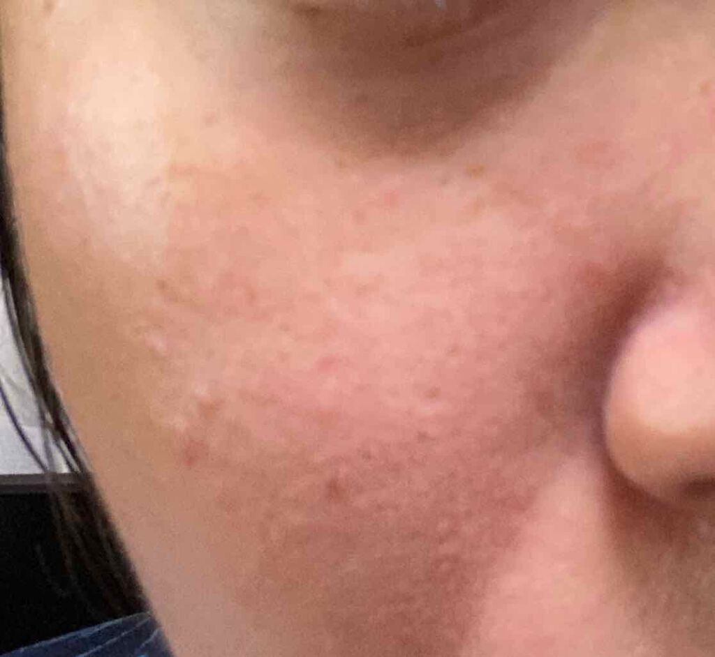 ルクエ スタートアップキット/ナリス化粧品/スキンケアキットを使ったクチコミ（2枚目）