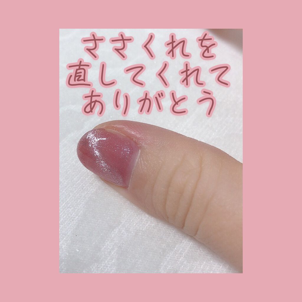 ユースキン ユースキンの口コミ 指のささくれ 治ったよ ユースキンaa効能 By Juri 100 フォロバ Lips