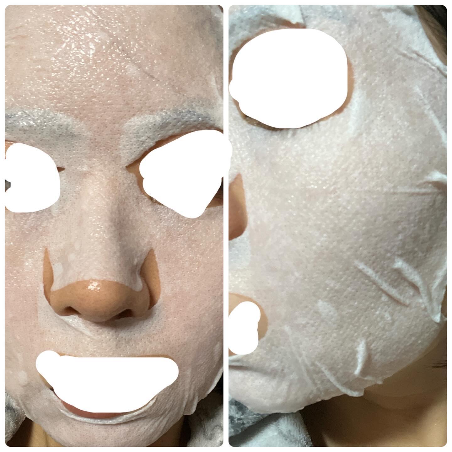 バイオームバリアシートマスク/UIQ/シートマスク・パックを使ったクチコミ（3枚目）