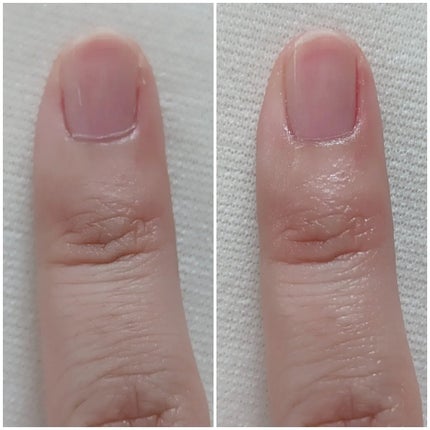 キューティクルペン/enieni /ネイルオイル・トリートメントを使ったクチコミ(5枚目)