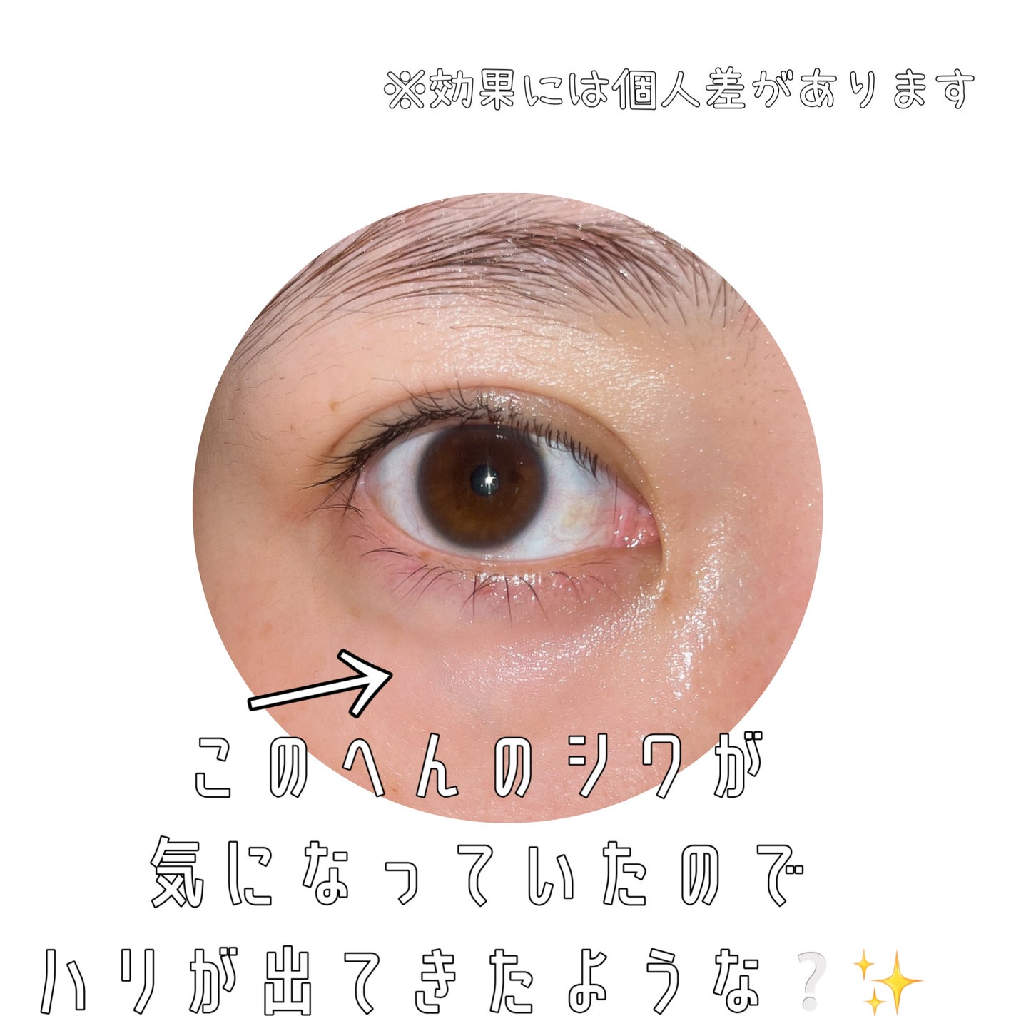 リンクルノンノン/jojo/美容液を使ったクチコミ(6枚目)