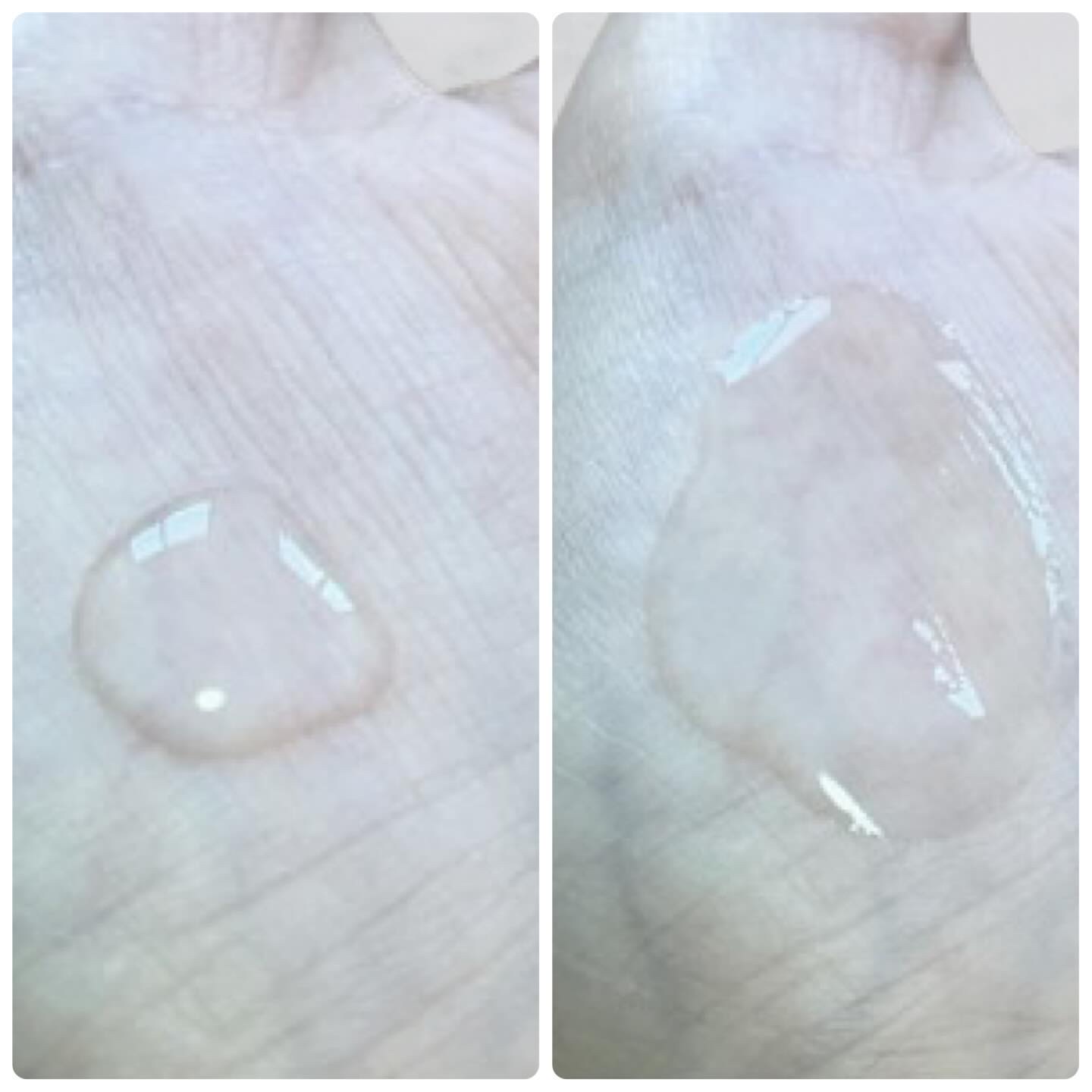 ノスカナイン トラブル セラム/FATION/美容液を使ったクチコミ（3枚目）