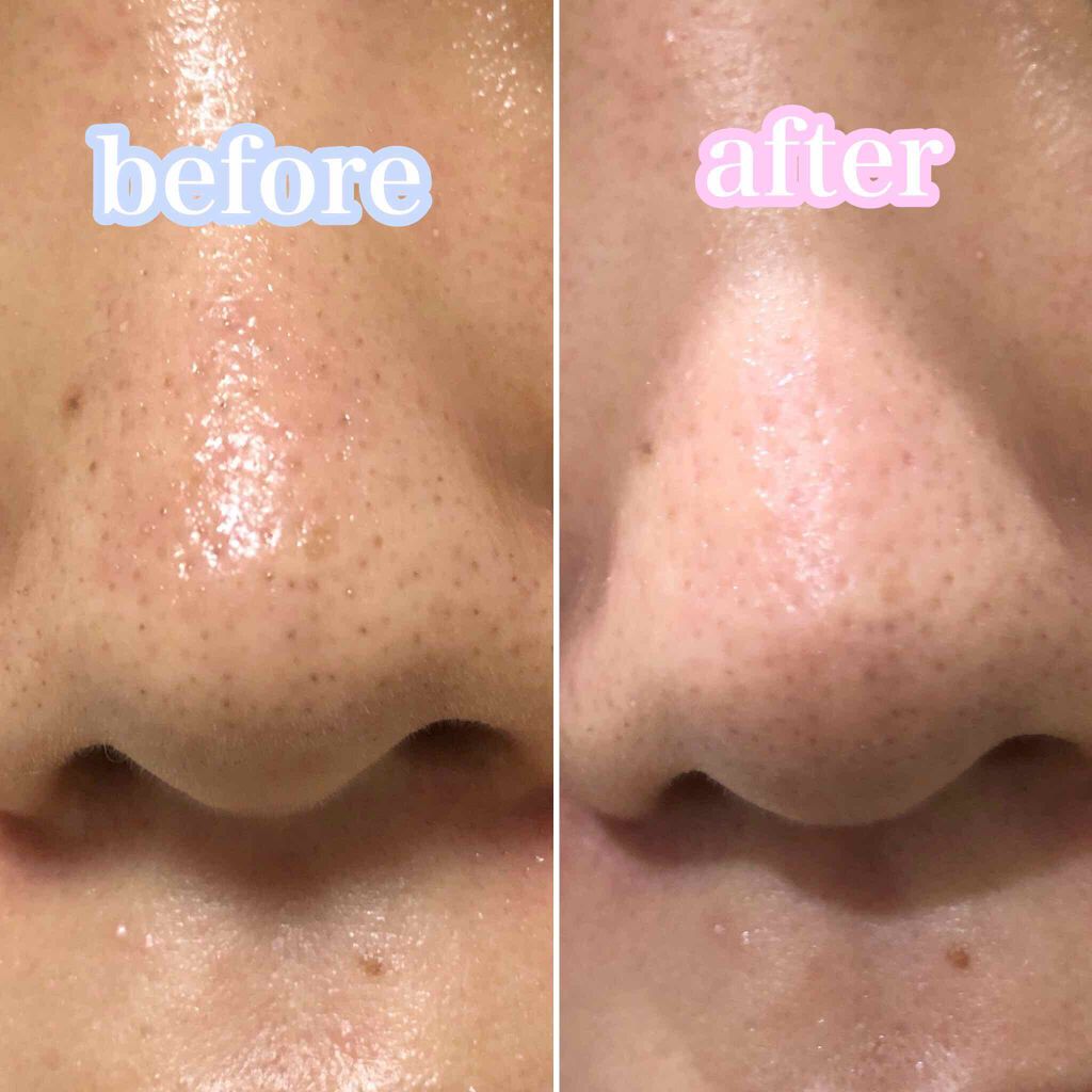 毛穴すっきりパック 鼻用 白色タイプ/ビオレ/その他スキンケアを使ったクチコミ（2枚目）