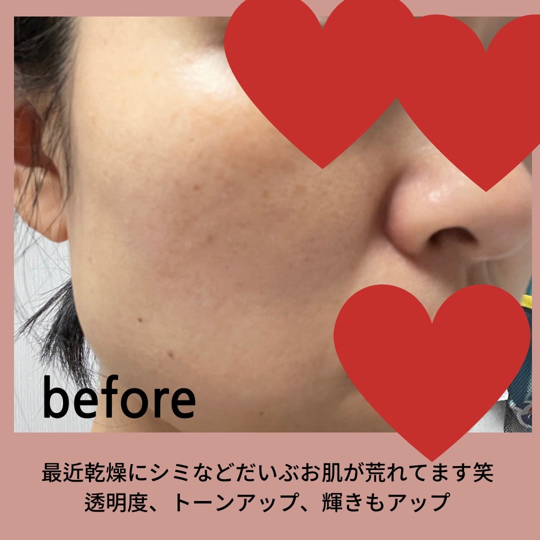 バイオ コンディショニング エッセンス/IOPE/ブースター・導入液を使ったクチコミ(4枚目)