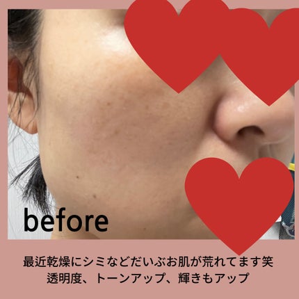 バイオ コンディショニング エッセンス/IOPE/ブースター・導入液を使ったクチコミ(4枚目)