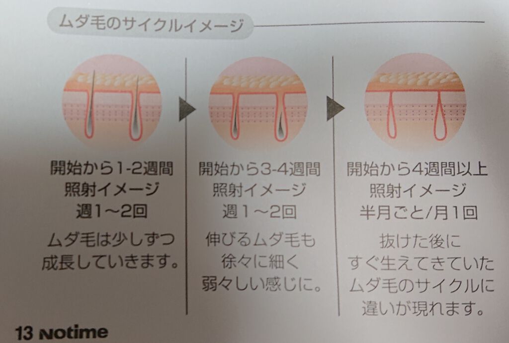 アイスレディ/icelady/家庭用脱毛器を使ったクチコミ（3枚目）