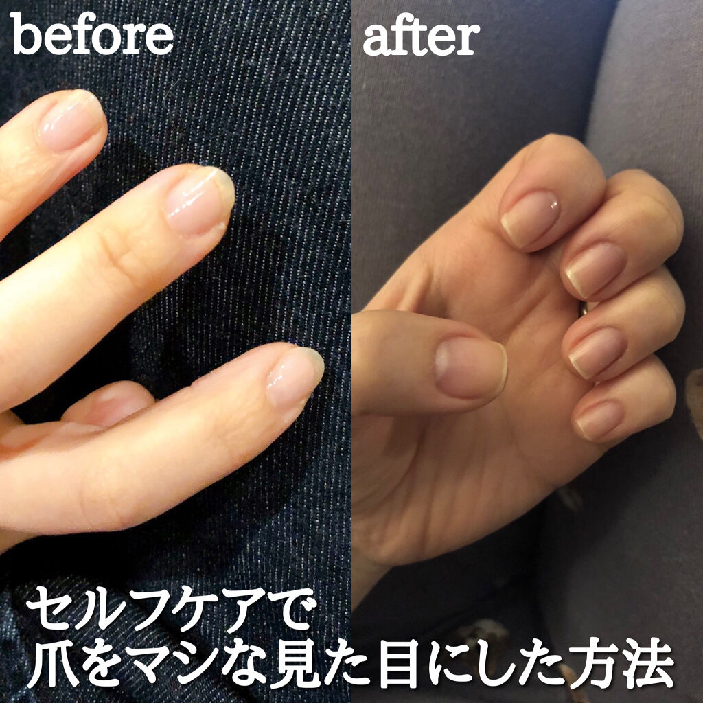 ビューティーチャージ 無香料/アトリックス/ハンドクリームを使ったクチコミ（1枚目）