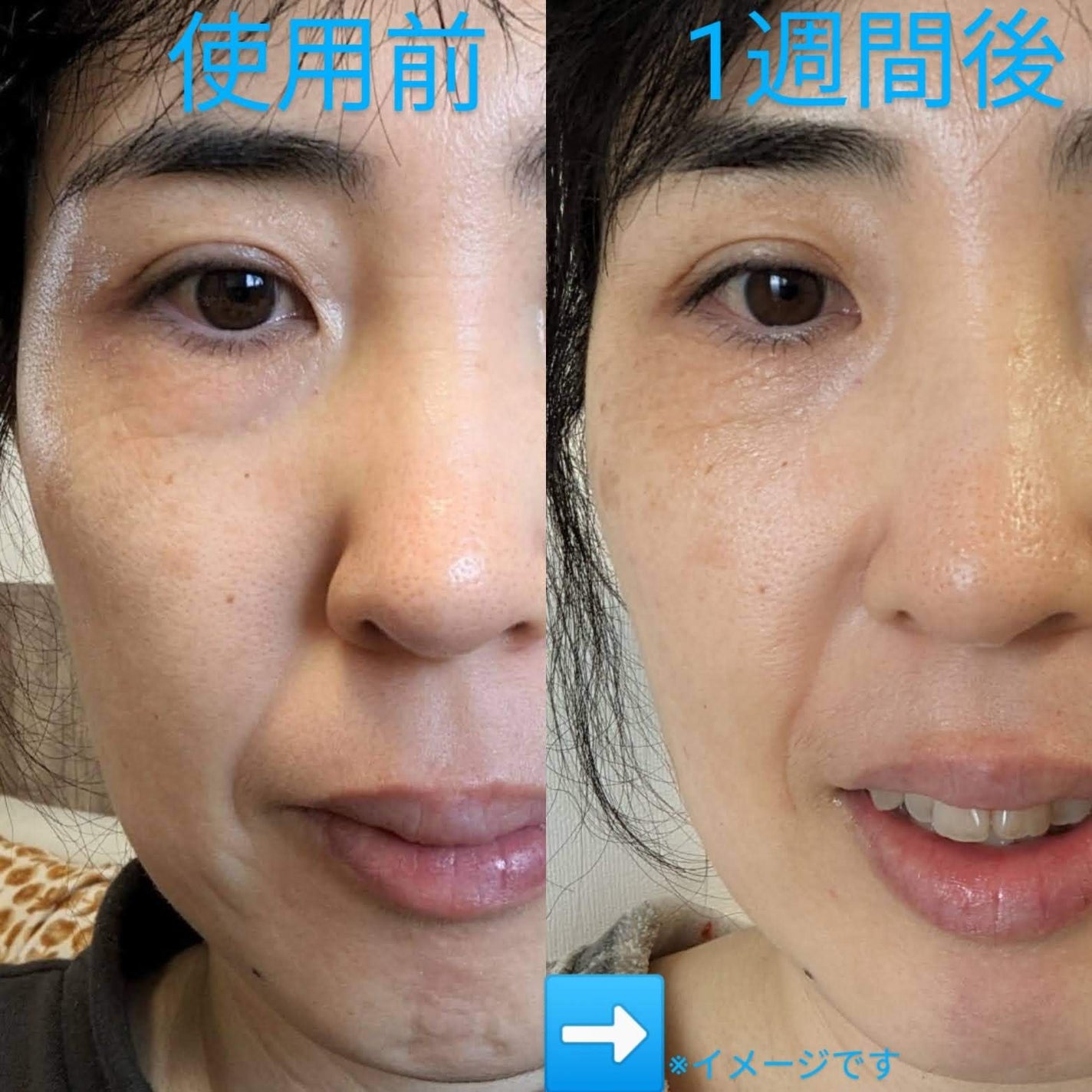 ディープビタCアンプル2.0/MEDICUBE/美容液を使ったクチコミ(1枚目)