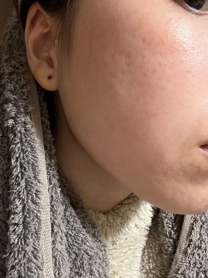 アルージェ エンリッチ ミルク/アルージェ/乳液を使ったクチコミ(2枚目)