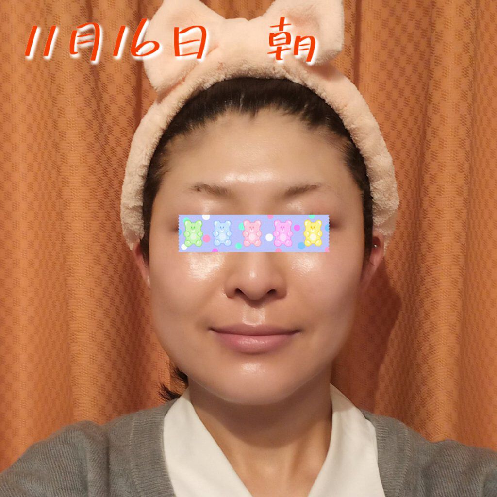 レチノールA 1% アドバンスドリバイタリゼーションクリーム/Life-flo/フェイスクリームを使ったクチコミ（1枚目）