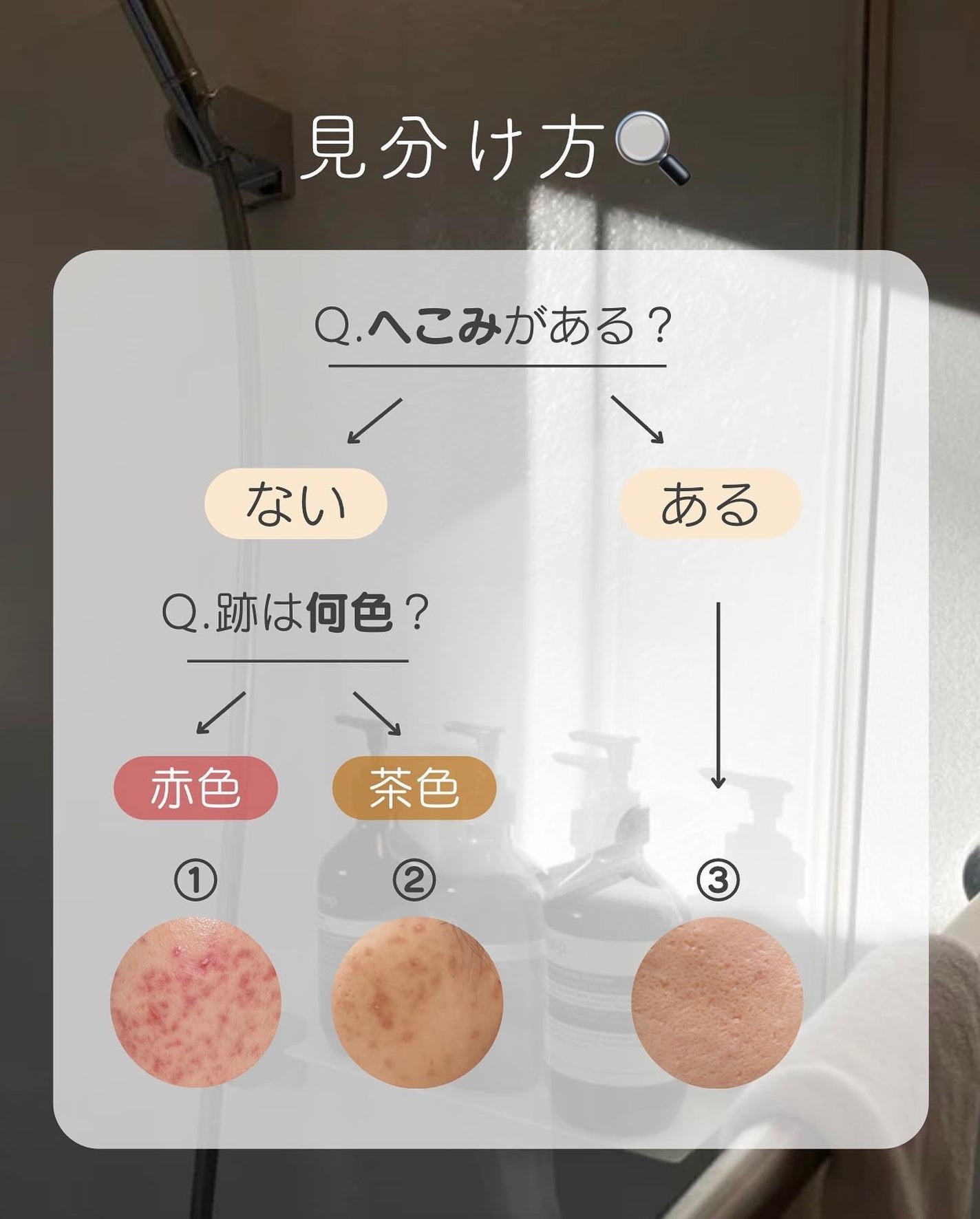 白湯(サユ) | ニキビと戦うOL🤍 on LIPS 「ニキビ跡ってどうやったら治るの😭😭って人集合!ニキビ跡って気..」(3枚目)