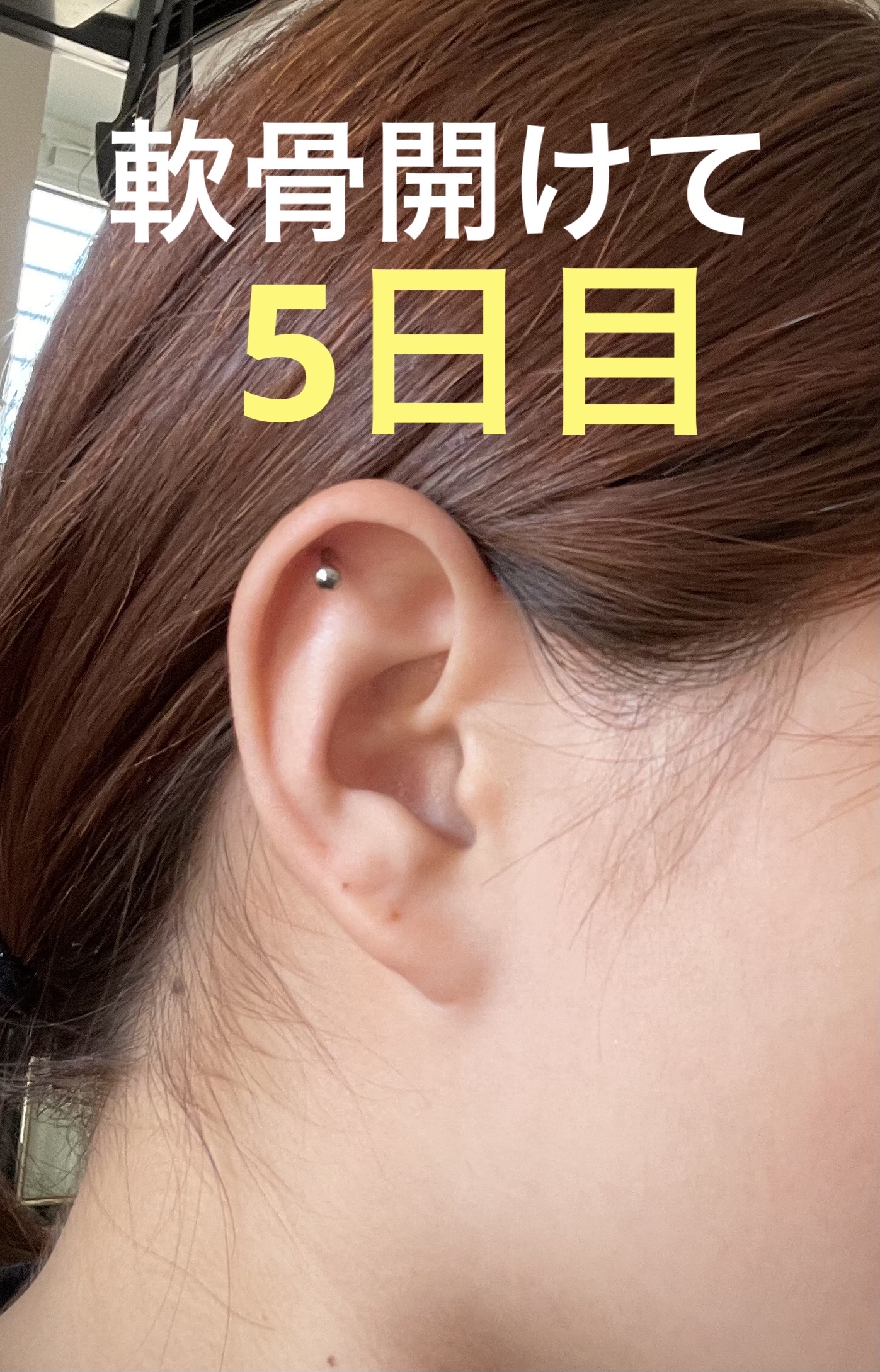 瞬間ピアッサー Q66/ヒーロー /その他を使ったクチコミ（1枚目）