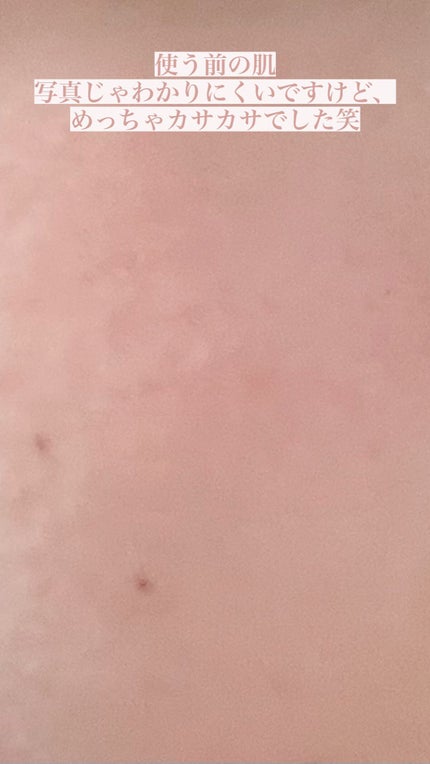 毛穴小町 テカリ源治 マスク/クリアターン/シートマスク・パックを使ったクチコミ(4枚目)