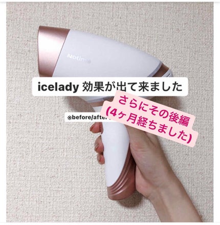 アイスレディ|iceladyの効果に関する口コミ - icelady 効果が出 アイスレディ|iceladyの効果に関する口コミ - icelady 効果が出