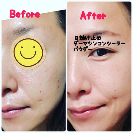 ダーマシンコンシーラー/23years old/リキッドコンシーラーを使ったクチコミ(4枚目)