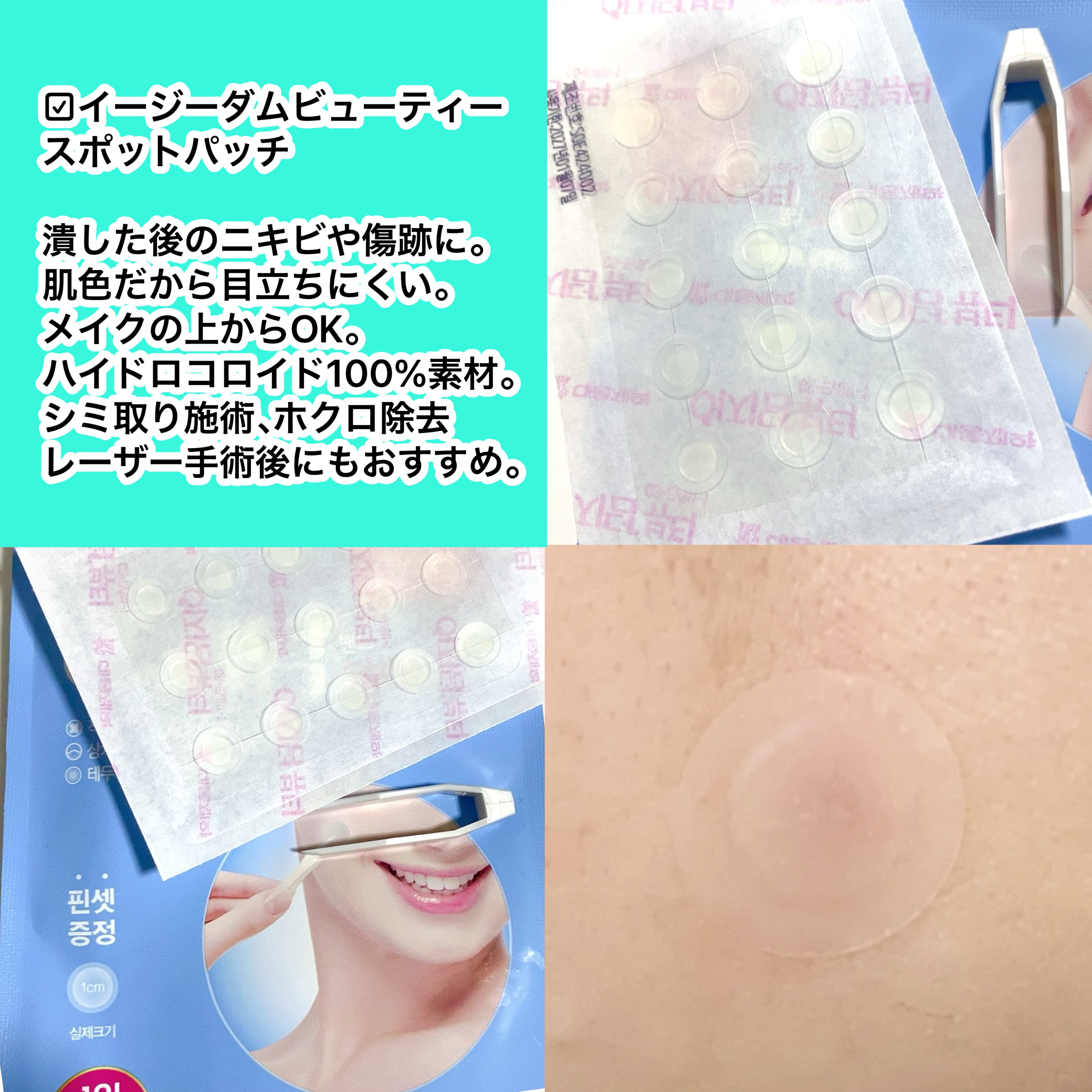 ビューティー スポットパッチ/イージーダムビューティー/にきびパッチを使ったクチコミ（3枚目）