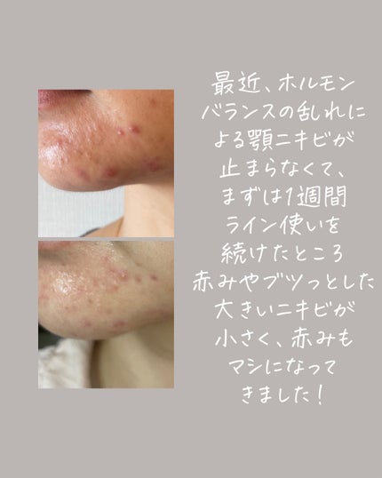 マジックトラブル洗顔/ブラン/洗顔フォームを使ったクチコミ(9枚目)