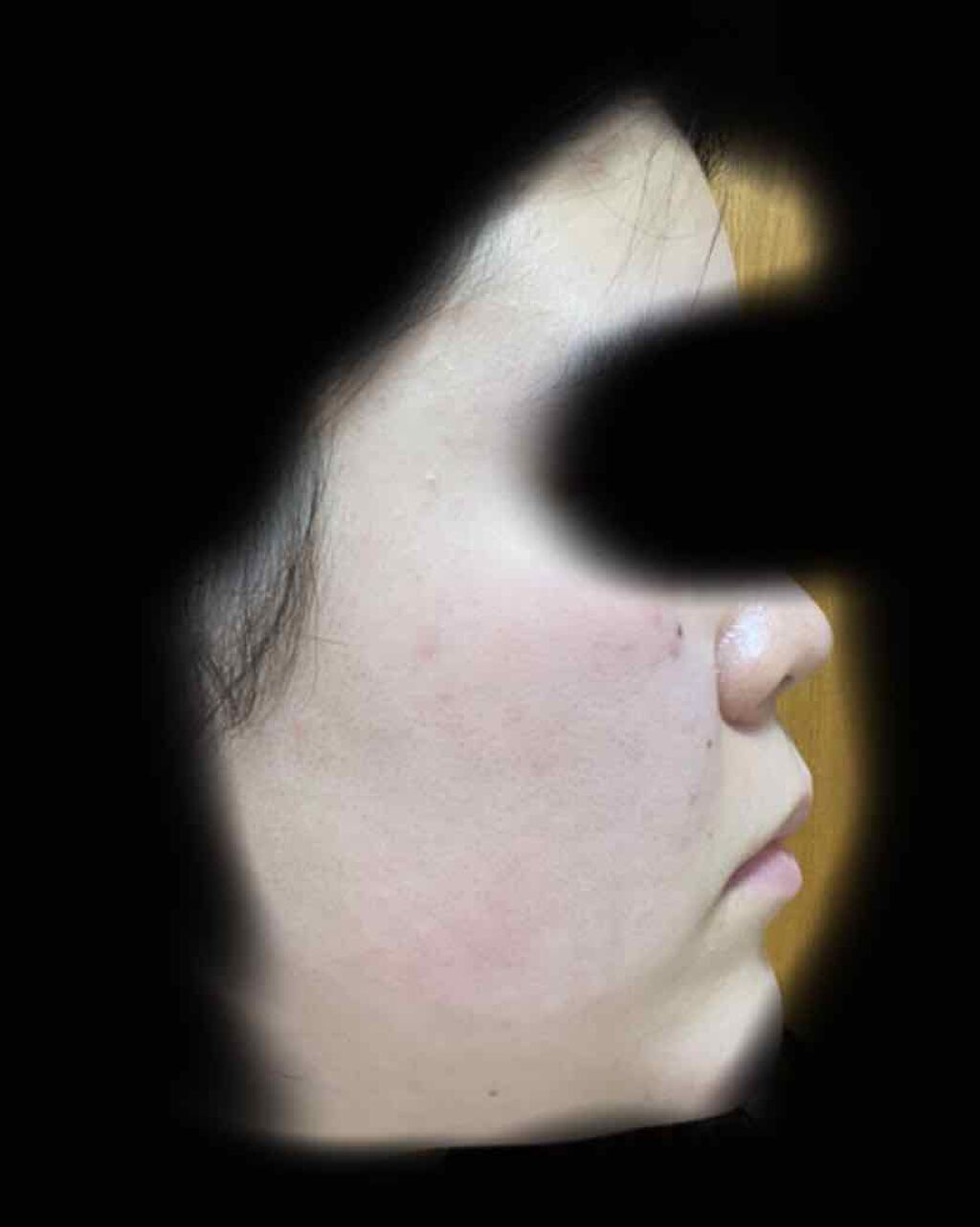 ハトムギ化粧水(ナチュリエ スキンコンディショナー R )/ナチュリエ/化粧水を使ったクチコミ(4枚目)