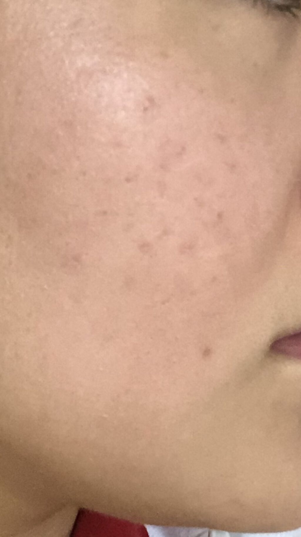 ノブ Ａ アクネソープ/NOV/洗顔石鹸を使ったクチコミ（1枚目）