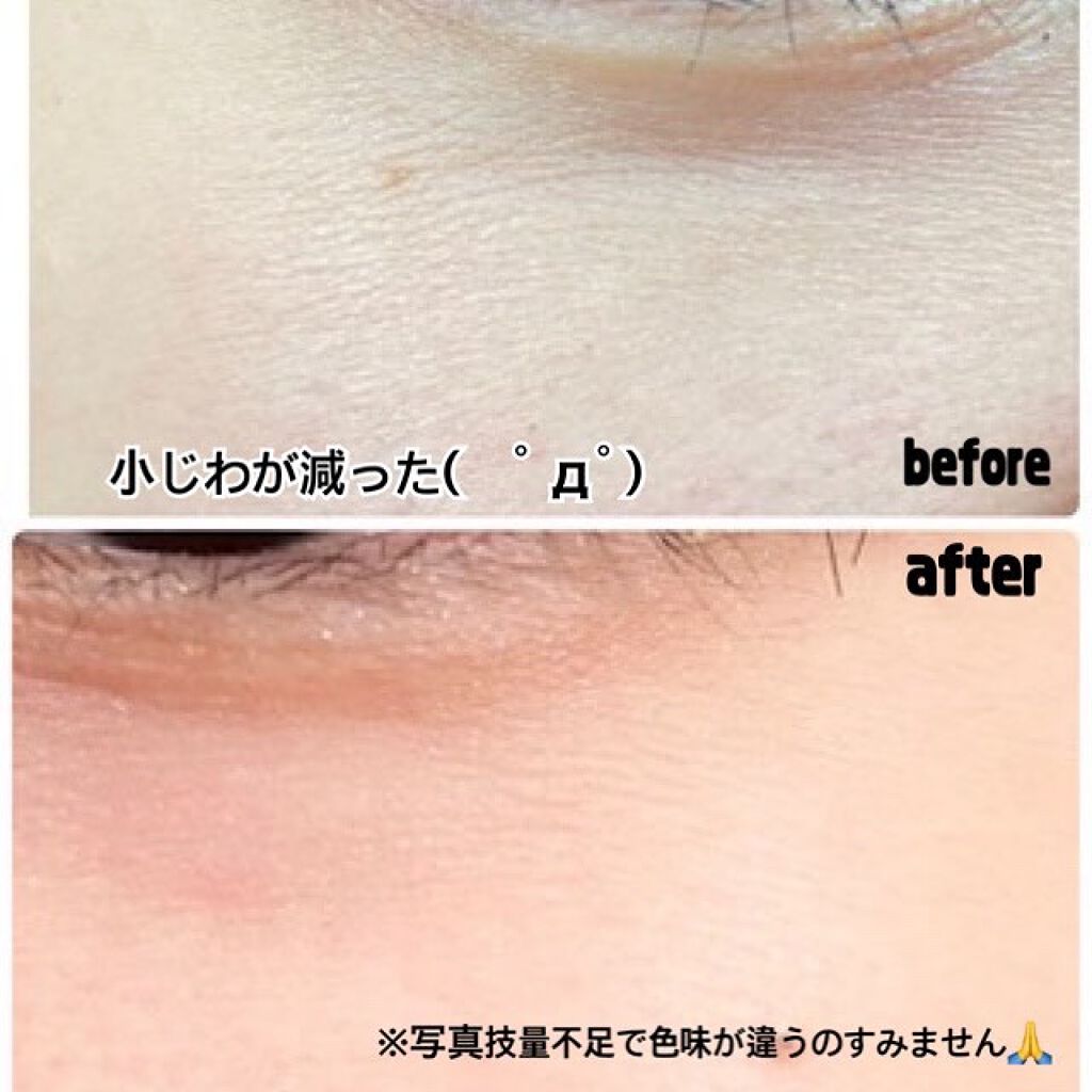 M コンデンスBセラム/UT Medical/美容液を使ったクチコミ(4枚目)