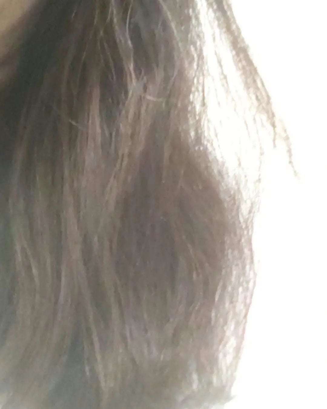 薬用 RJ地肌ケア エッセンス /アピセラピーコスメティクス/頭皮ローションを使ったクチコミ(5枚目)