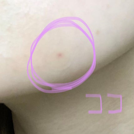 プロCICA クリアスポットパッチ/VT/その他スキンケアを使ったクチコミ(2枚目)