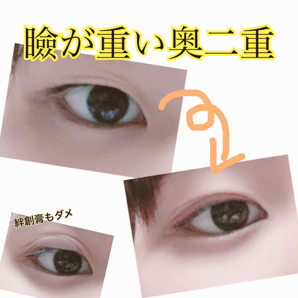 よねち on LIPS 「こんばんは!こんにちは!今回はワイの二重(?)事情について書き..」(1枚目)