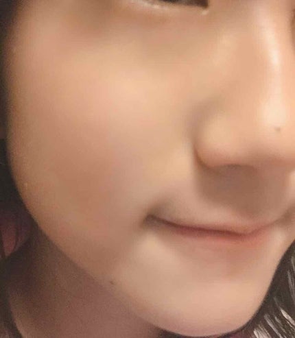 ハトムギ化粧水(ナチュリエ スキンコンディショナー R )/ナチュリエ/化粧水を使ったクチコミ(4枚目)