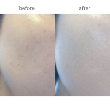 ヌーゼロクッション/rom&nd/クッションファンデーションを使ったクチコミ(5枚目)