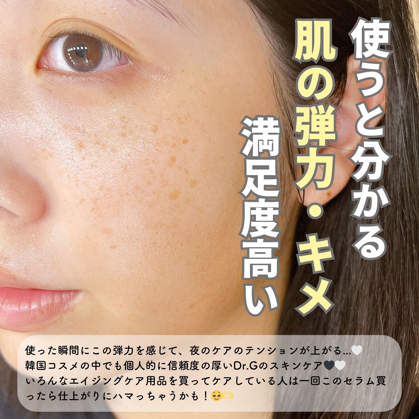 ブラックスネイルレチノールセラム/Dr.G/美容液を使ったクチコミ(6枚目)