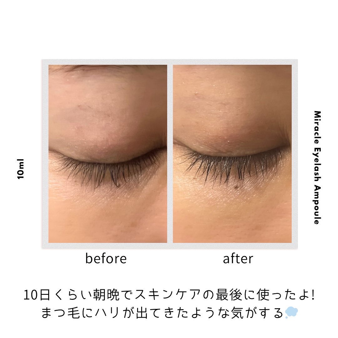 ミラクルアイラッシュアンプル/deartique/まつげ美容液を使ったクチコミ（3枚目）