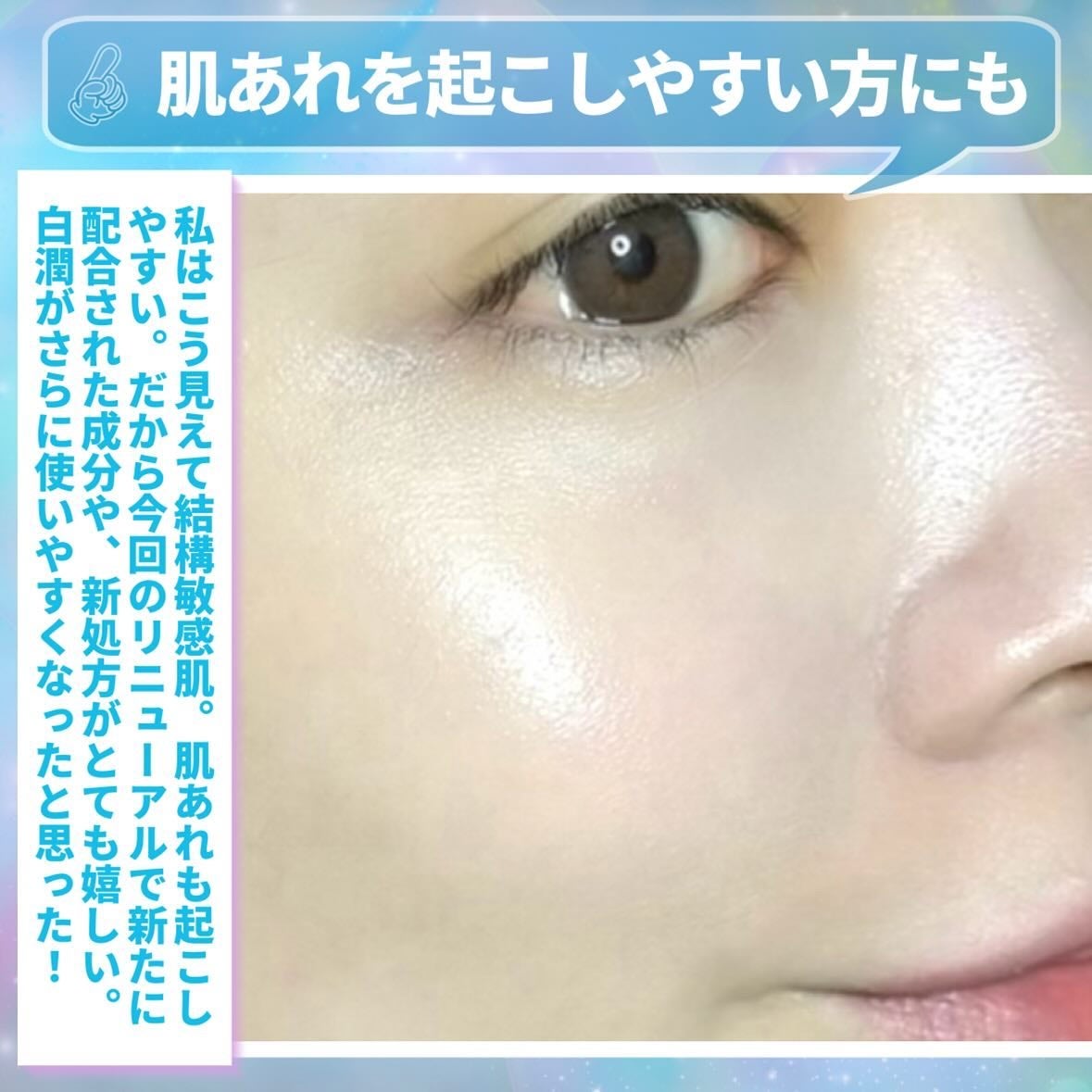 白潤薬用美白化粧水/肌ラボ/化粧水を使ったクチコミ(5枚目)