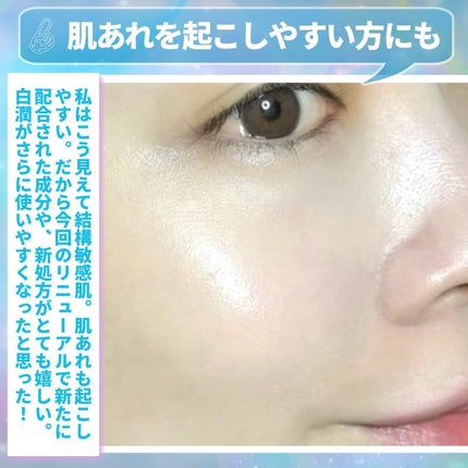 白潤薬用美白化粧水/肌ラボ/化粧水を使ったクチコミ(5枚目)