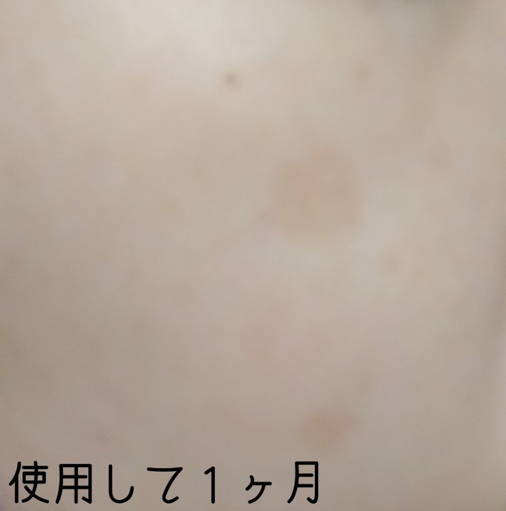 グリーンタンジェリン ビタC ダークスポットケアセラム/goodal/美容液を使ったクチコミ(4枚目)