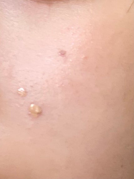 ディオール バックステージ フラッシュ パーフェクター コンシーラー 3N ニュートラル/Dior/コンシーラーの画像