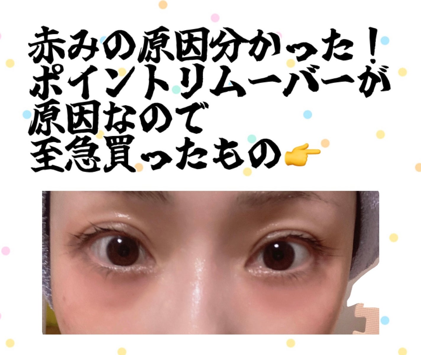 イドラビオ エイチツーオー/ビオデルマ/クレンジングウォーターを使ったクチコミ(1枚目)